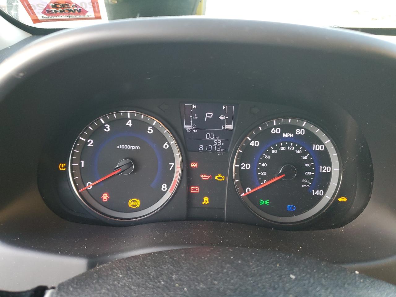Hyundai ACCENT Se