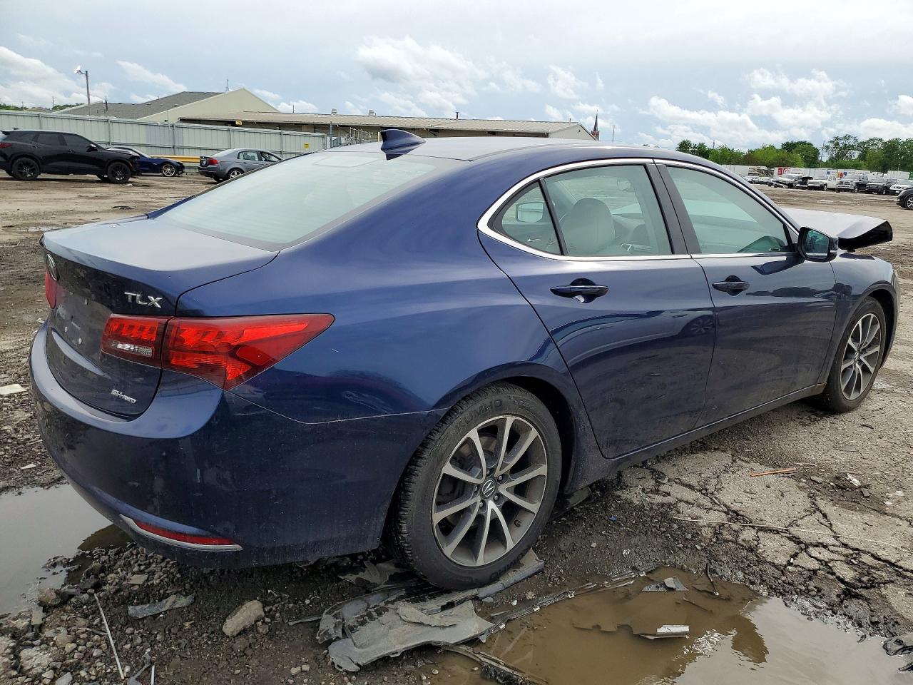 Acura TLX Tech