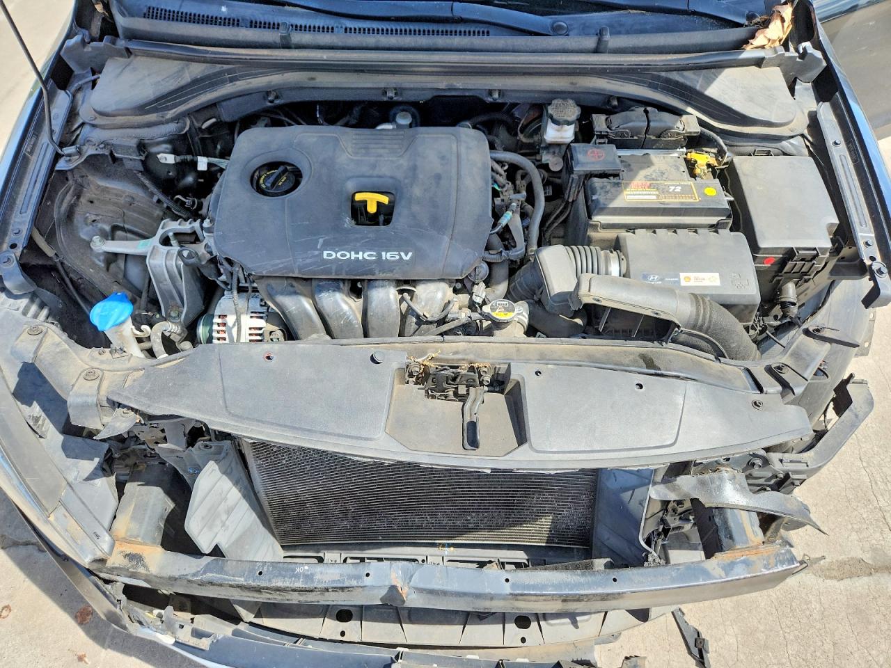 Hyundai ELANTRA Se
