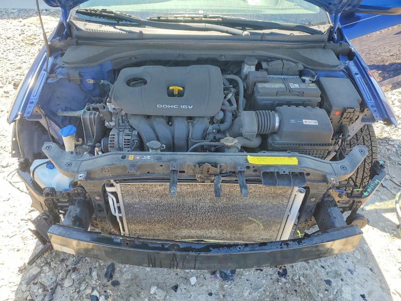 Hyundai ELANTRA Se