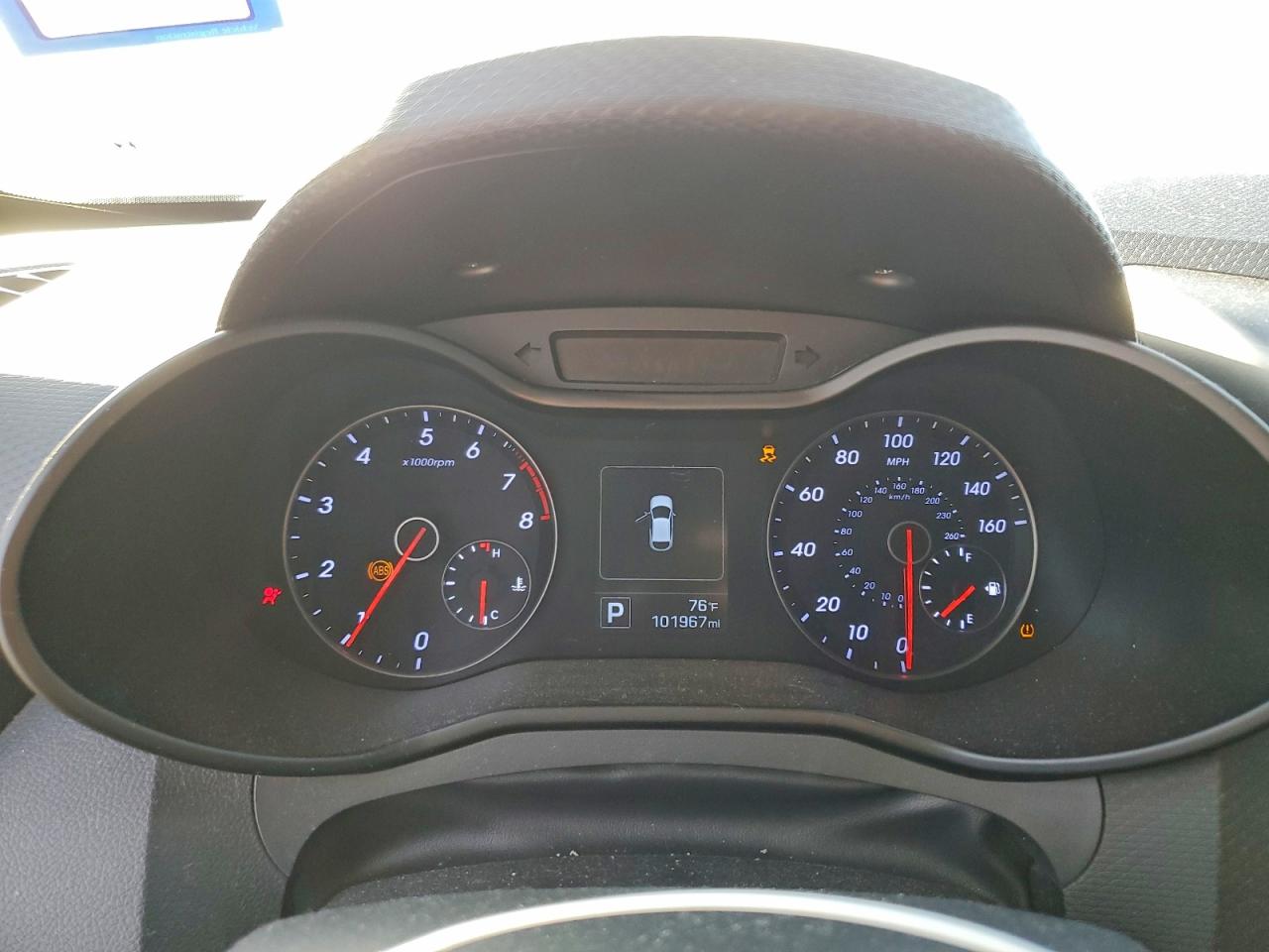 Hyundai VELOSTER Turbo