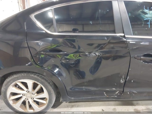 Acura ILX Acurawatch Plus Package
