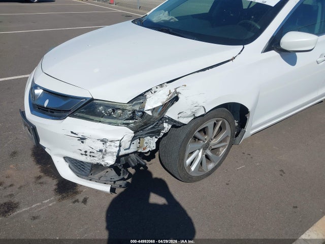 Acura ILX Acurawatch Plus Package