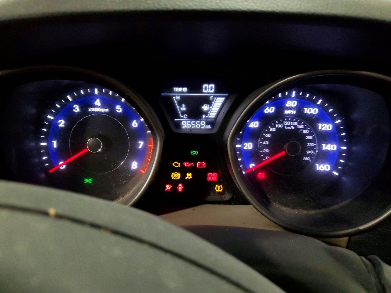 Hyundai ELANTRA Se