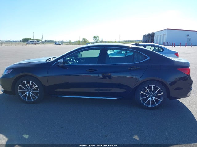 Acura TLX Tech Pkg
