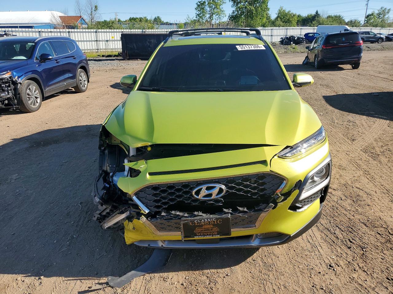 Hyundai KONA Ultimate
