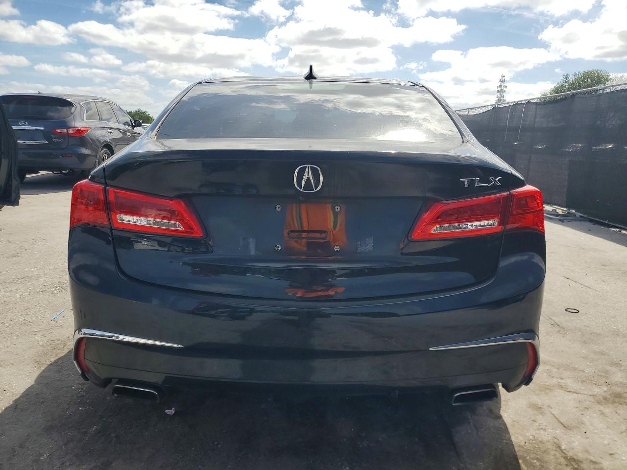 Acura TLX Tech