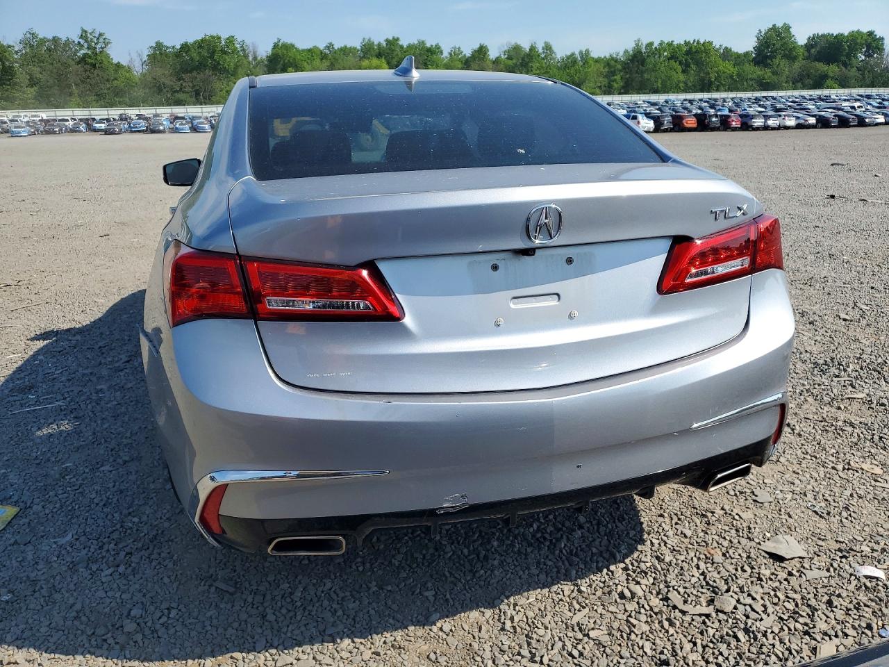 Acura TLX Technology
