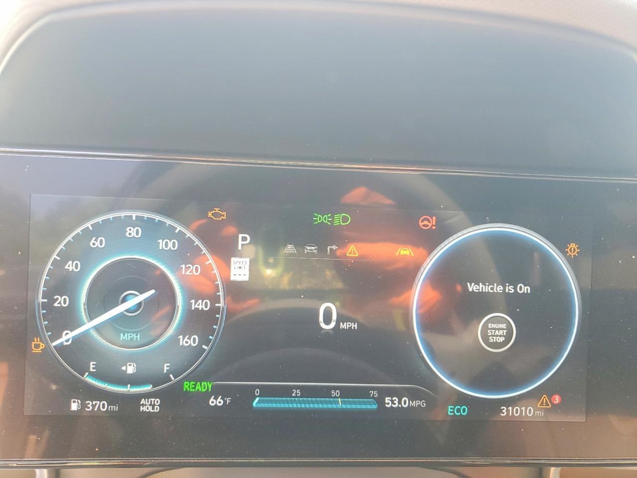 Hyundai ELANTRA Sel Sport