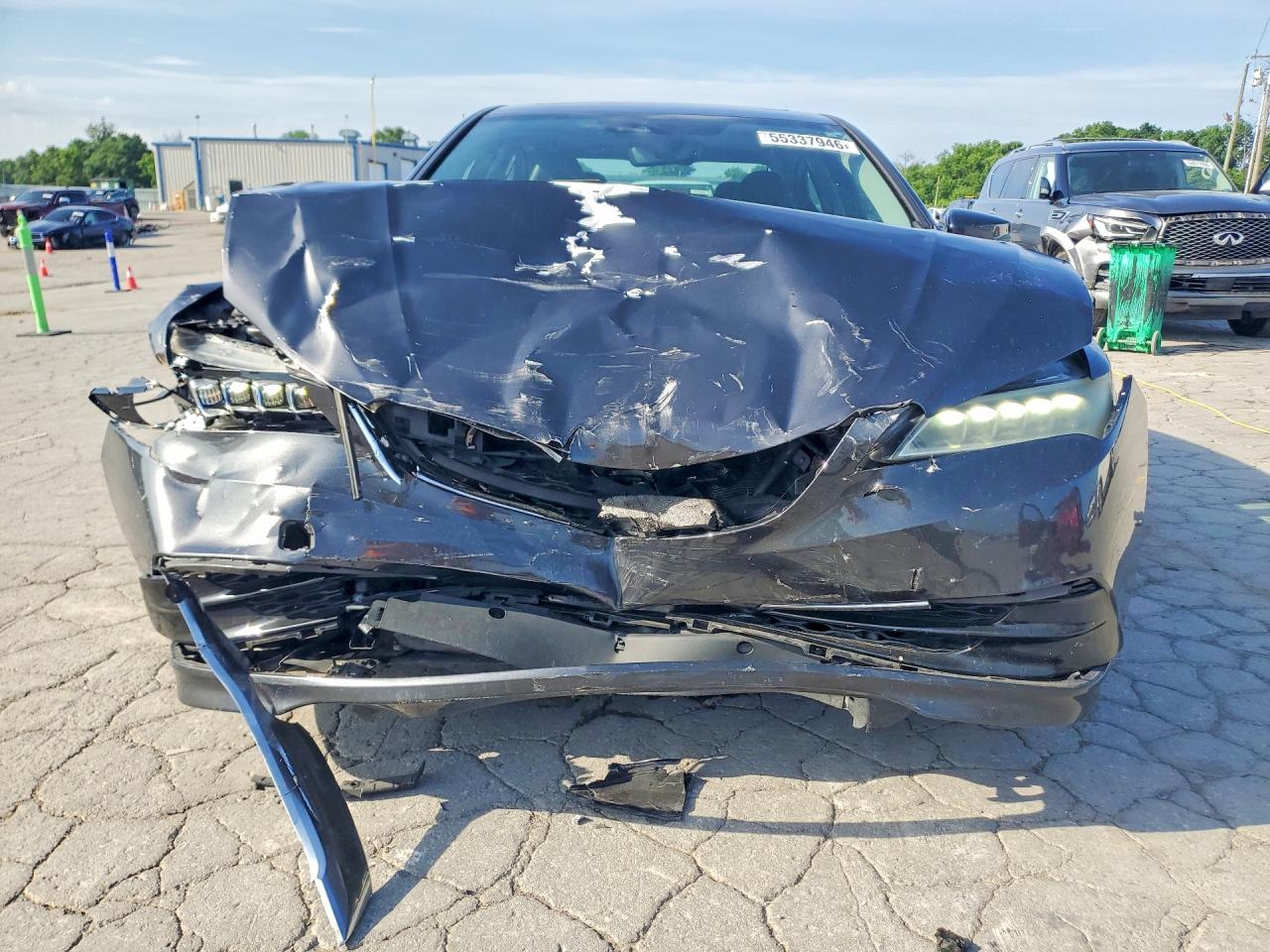 Acura TLX Tech