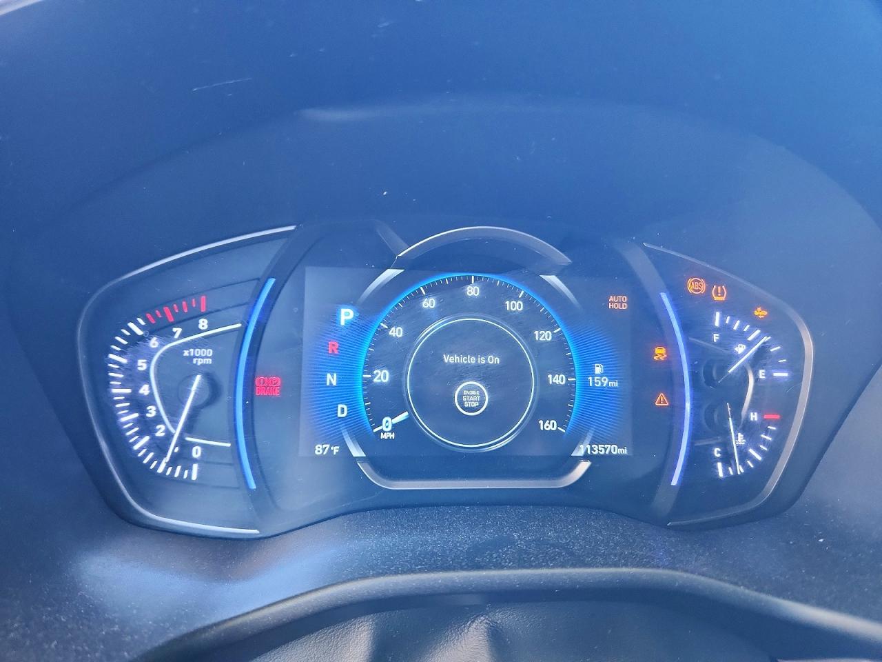 Hyundai SANTA FE Ultimate 2.4l