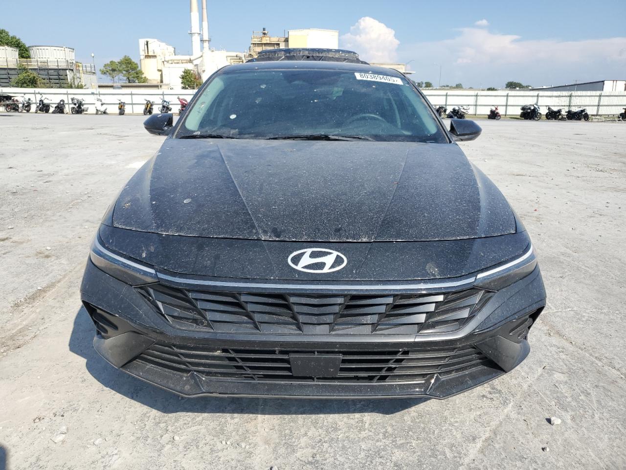 Hyundai ELANTRA Sel Convenience