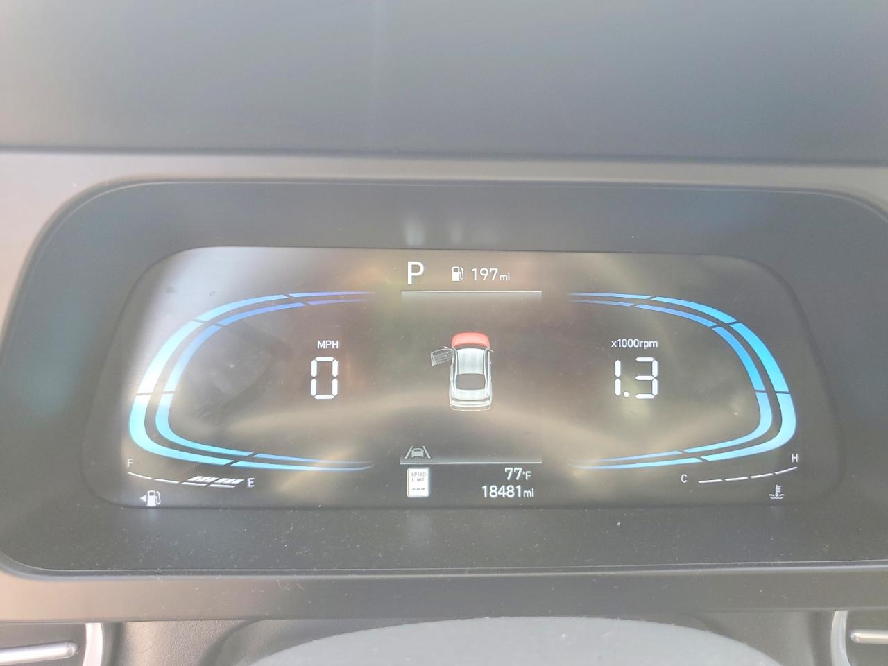 Hyundai ELANTRA Sel Sport