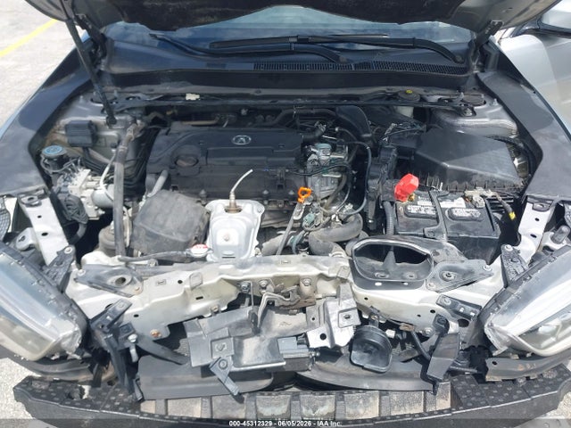 Acura TLX Tech Package