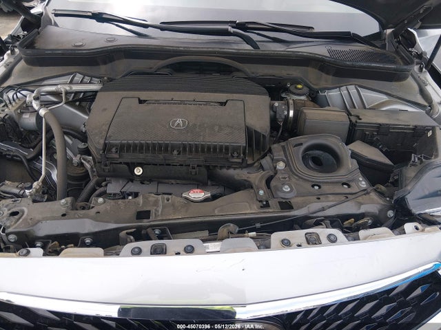 Acura MDX Technology Package