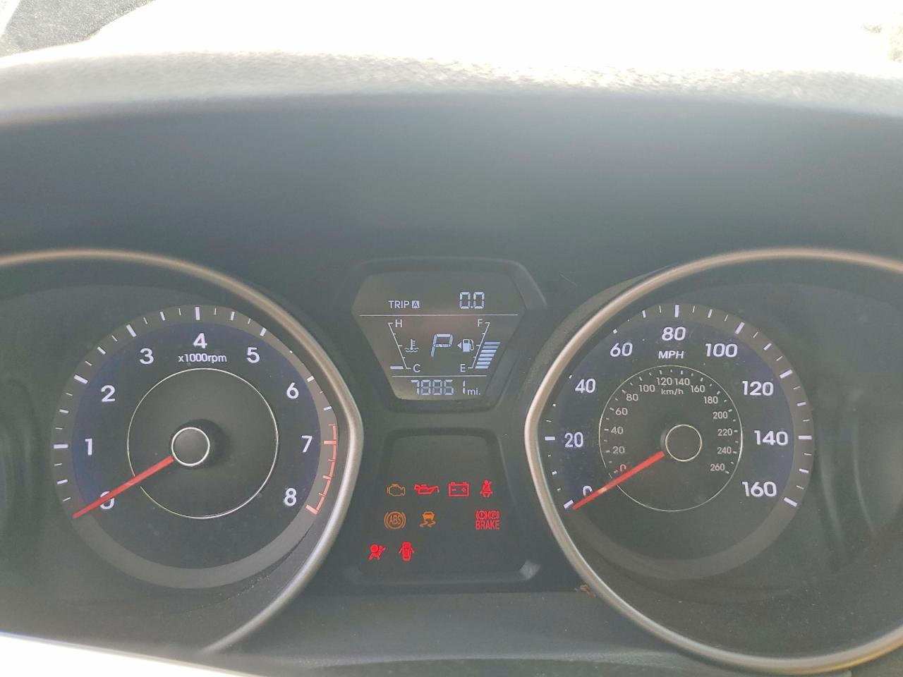 Hyundai ELANTRA Se